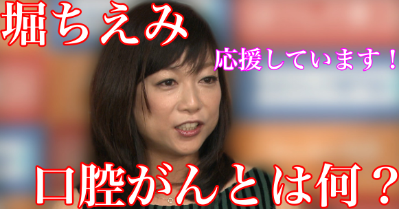 堀ちえみの口腔がん(舌がん)の症状と治療法は?ステージ4生存率は〇〇%!